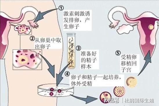 供卵的孩子和母亲没有血缘吗【非血缘母子：供卵孩子的成长之路】