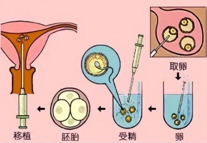 供卵的孩子跟母体有血缘关系吗【供卵孩子与母体是否有血缘关系？】