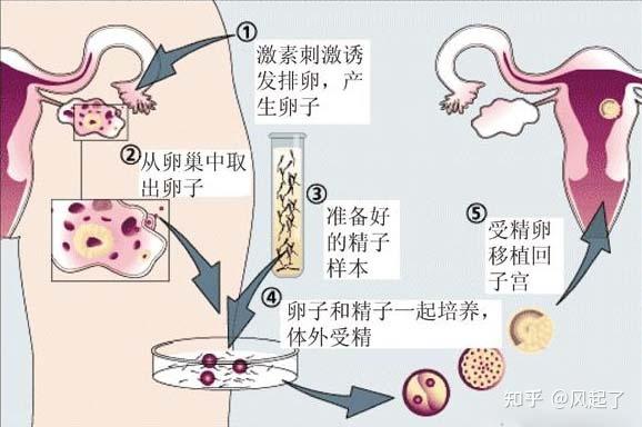 供卵是违法的吗(供卵合法化：是违法的吗？)
