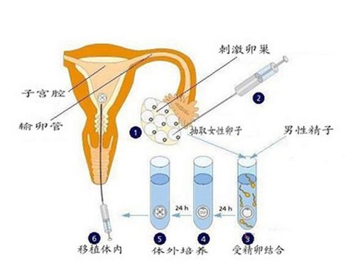 供卵生的孩子和自己有血缘吗(供卵生孩子,是否有血缘关系?)
