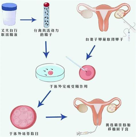 供卵需要具备什么条件(供卵需具备哪些条件?)