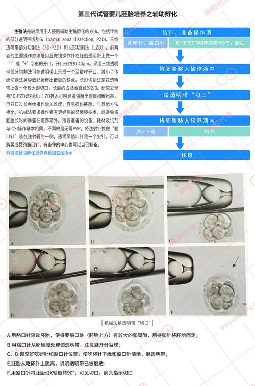 供卵试管代怀方法(供卵试管代怀:新生育方法解析)